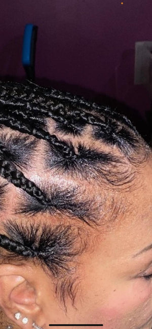 Effective Solutions for Dry Scalp: Tips and Treatments