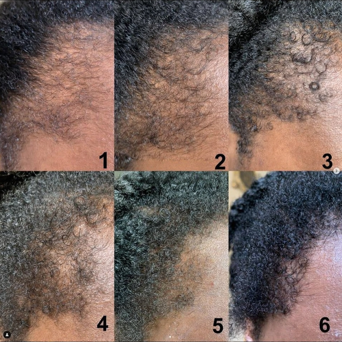 GOOD2GRO Complete Bundle | Thicker, Fuller Hair & Reduced Thinning — 7-Product System