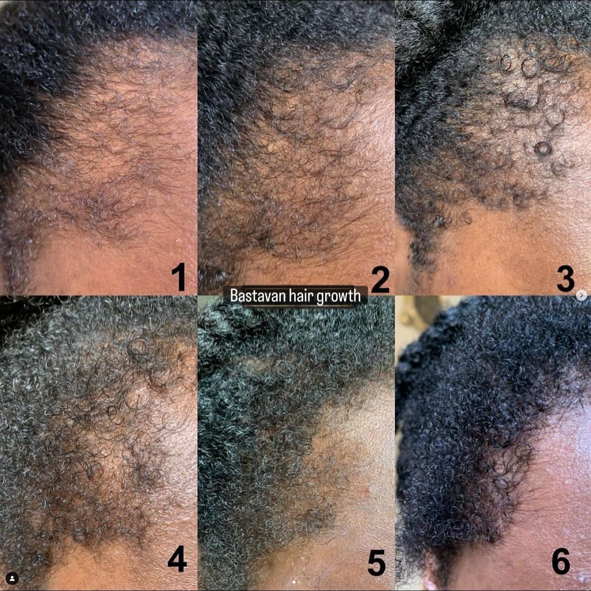 GOOD2GRO Biotin Leave-In Conditioner | Detangle, Reduce Breakage & Strengthen with Biotin & Collagen