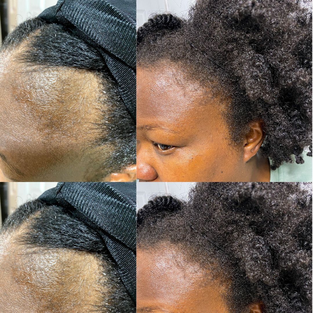 GOOD2GRO Biotin Leave-In Conditioner | Detangle, Reduce Breakage & Strengthen with Biotin & Collagen