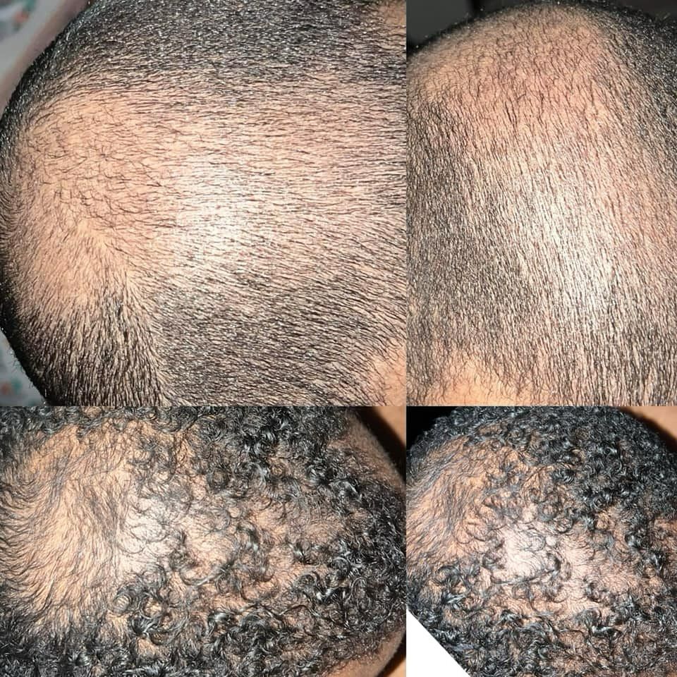 GOOD2GRO Growth & Repair Serum | Rosemary, Tea Tree & Peppermint for Hair Growth & Scalp Health