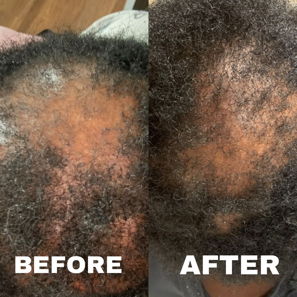 GOOD2GRO Growth & Repair Serum | Rosemary, Tea Tree & Peppermint for Hair Growth & Scalp Health