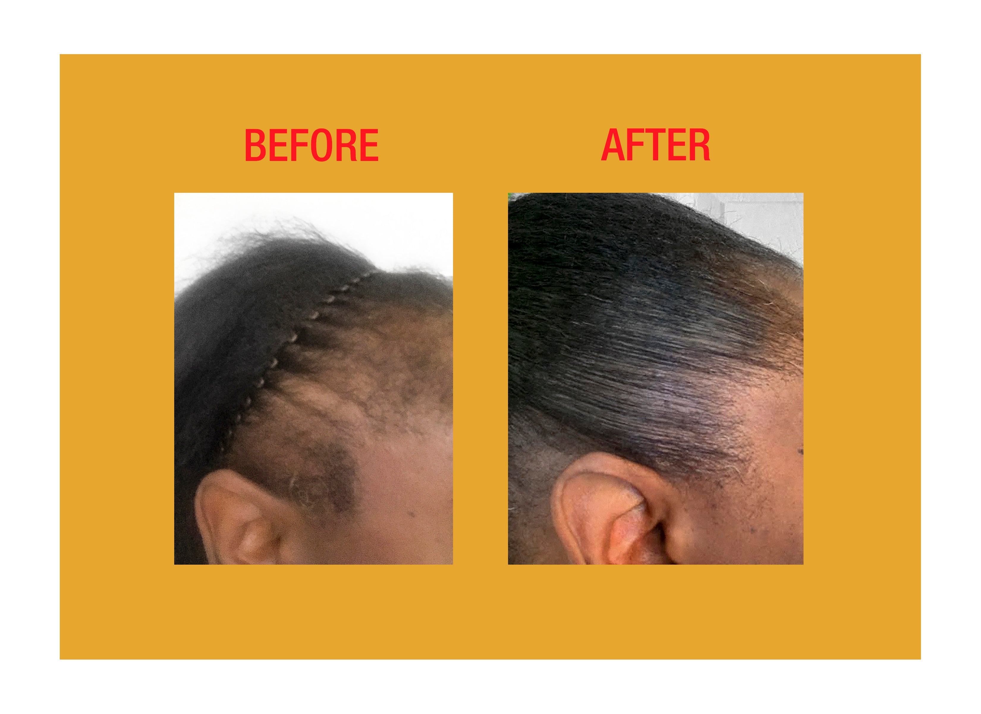 GOOD2GRO Biotin Edge Control Gel | Thinning Edges? Hold, Nourish & Grow Them Back