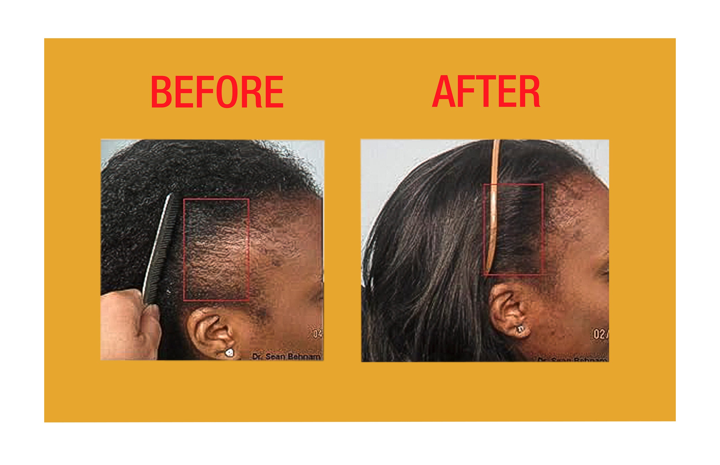 GOOD2GRO Edge Control Gel Instant Hold, Shine, Repair for Thicker Edges (Vegan)