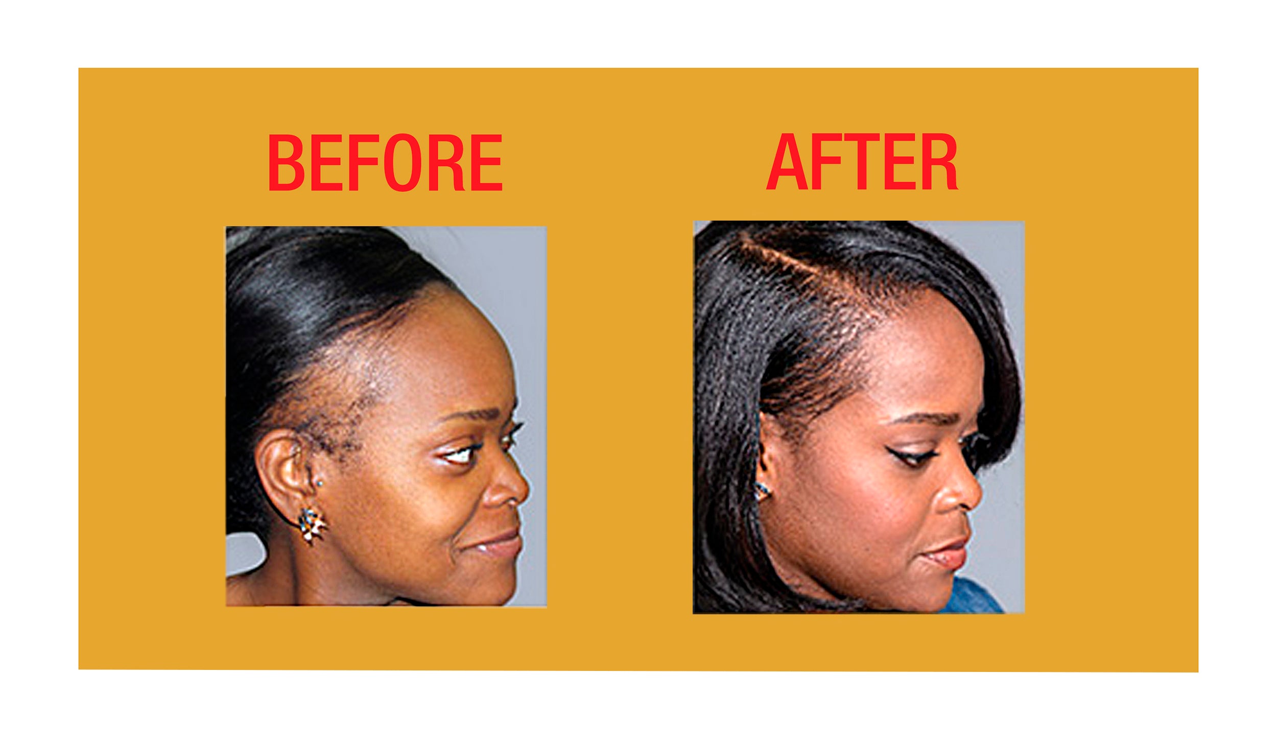 GOOD2GRO Biotin Set Growth & Thickening Shampoo + Conditioner (Vegan)