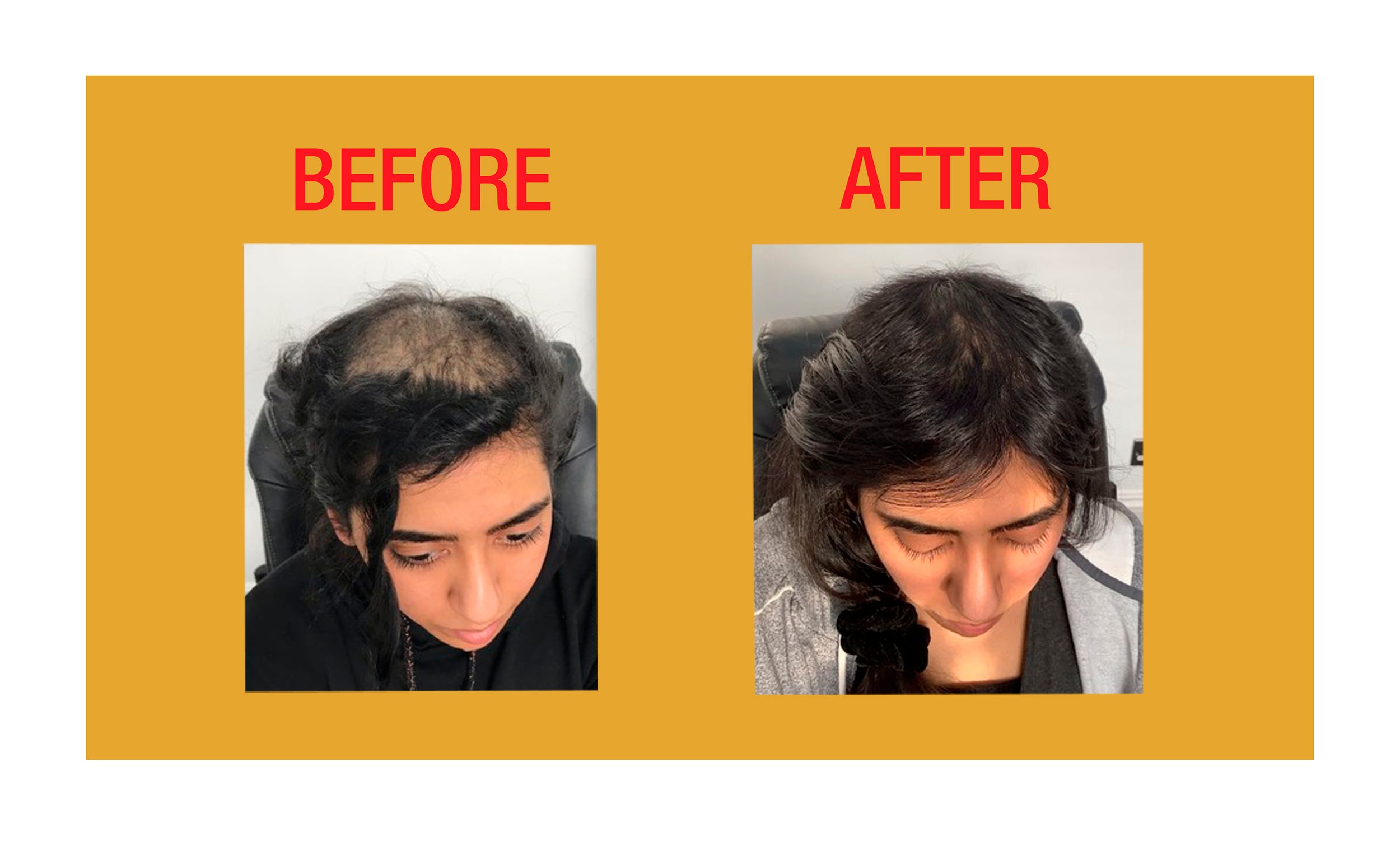 GOOD2GRO Biotin Leave-In Detangle, Reduce Breakage & Protect (Vegan)