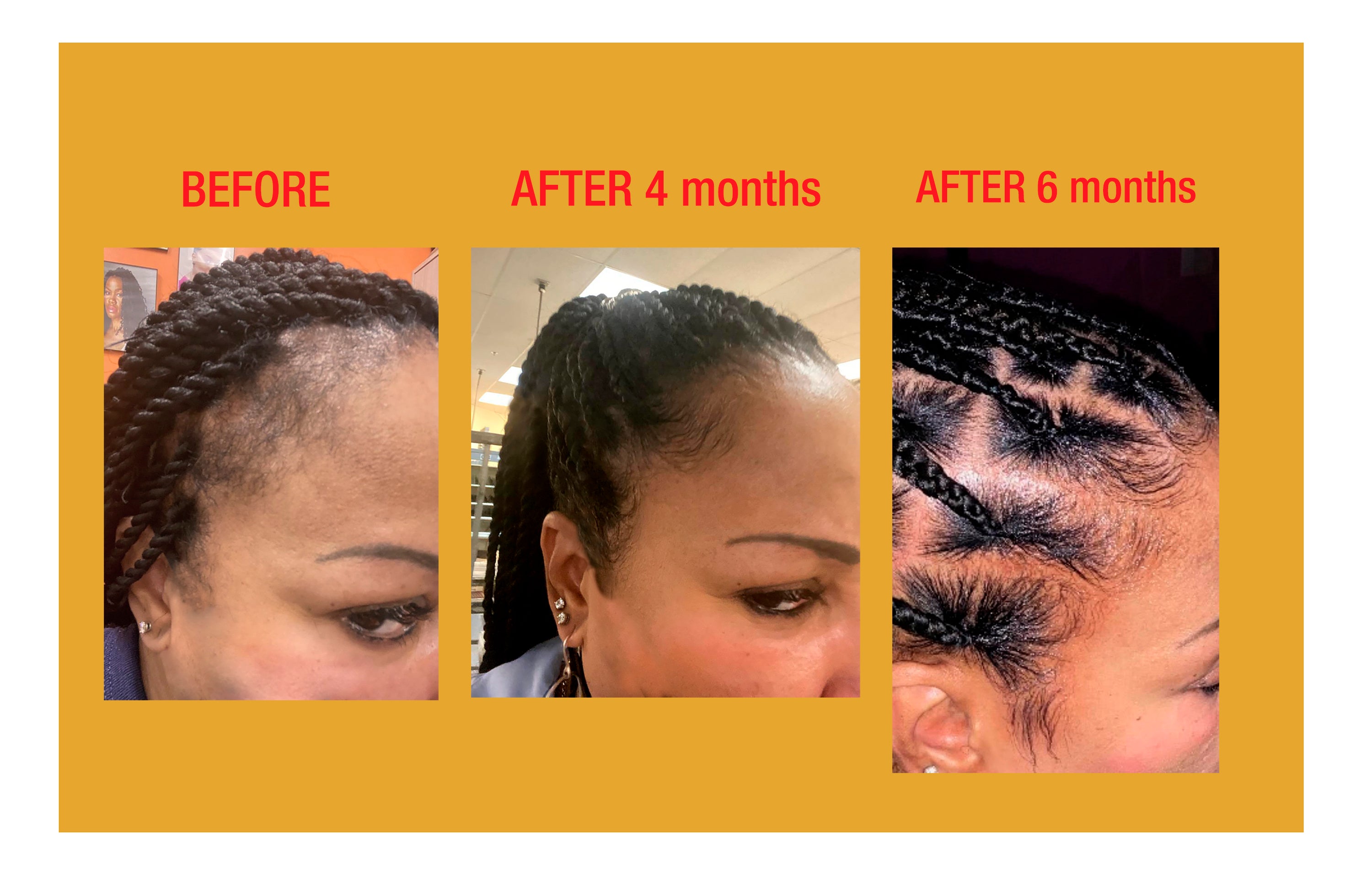 GOOD2GRO Biotin Hair Resuscitator | Thinning Edges & Damaged Roots? Repair & Grow Them Back