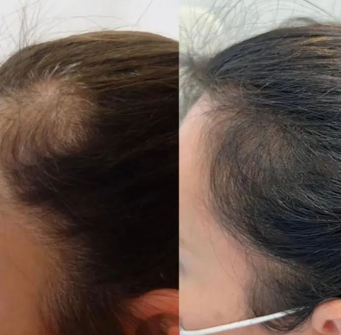 GOOD2GRO Biotin Leave-In Conditioner | Detangle, Reduce Breakage & Strengthen with Biotin & Collagen