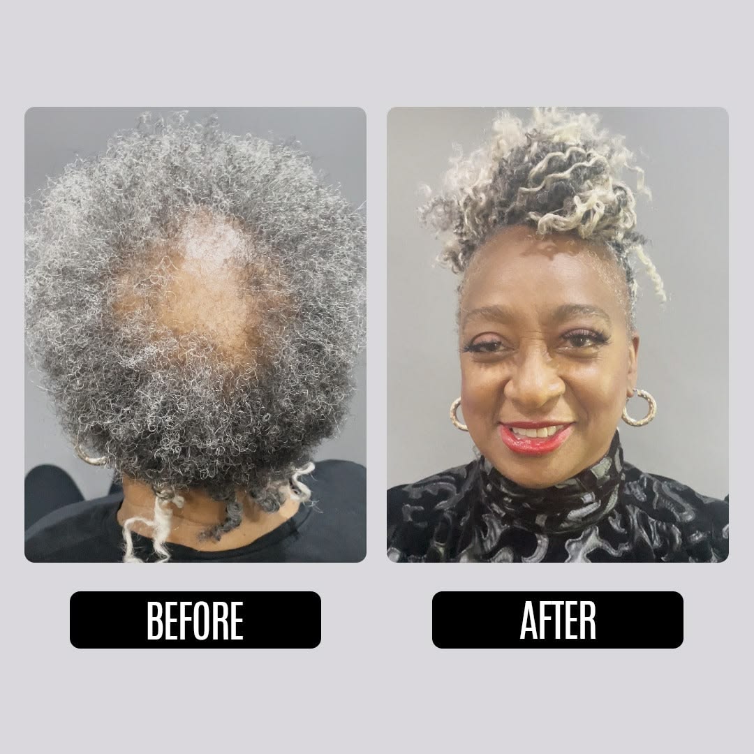 GOOD2GRO Biotin Growth Bundle | Complete System to Restore, Stimulate & Thicken Hair