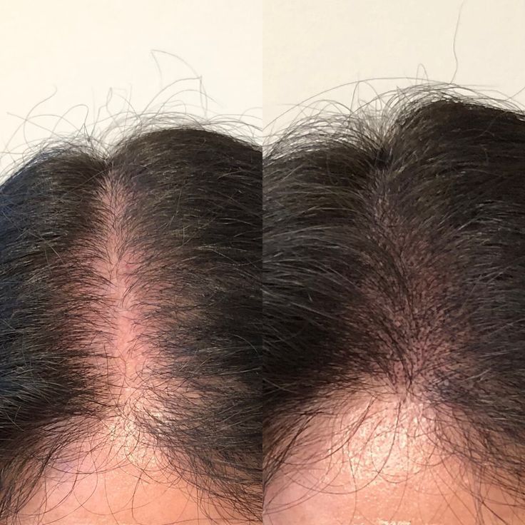 GOOD2GRO Biotin Leave-In Conditioner | Detangle, Reduce Breakage & Strengthen with Biotin & Collagen
