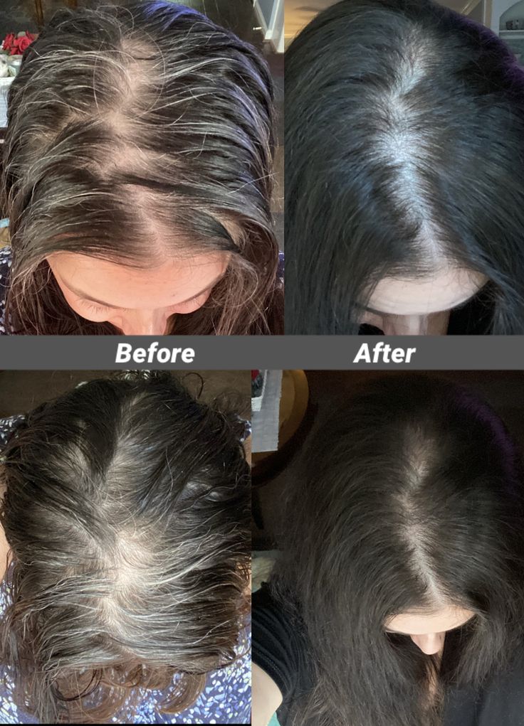 GOOD2GRO Biotin Leave-In Conditioner | Detangle, Reduce Breakage & Strengthen with Biotin & Collagen