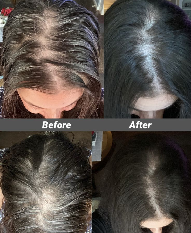 GOOD2GRO Leave-In Conditioner | Hydrate, Detangle & Repair for Healthy, Soft Hair