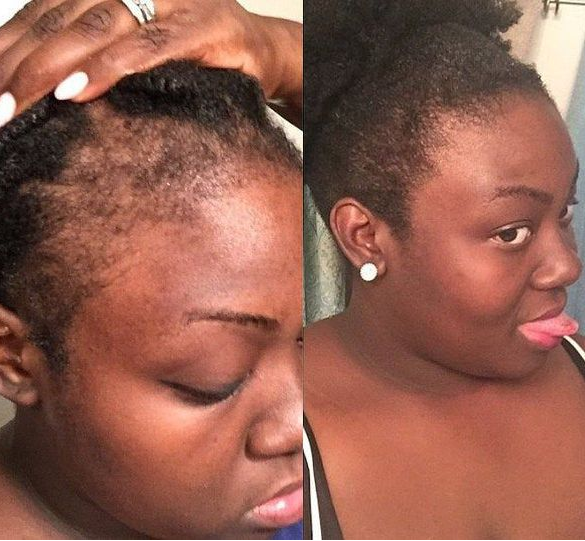 GOOD2GRO Growth & Repair Serum | Rosemary, Tea Tree & Peppermint for Hair Growth & Scalp Health